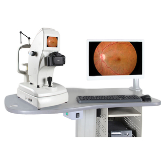 กล้อง Fundus / กล้องเรตินา
